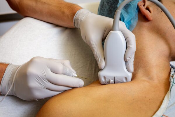 ultra sound guided Regional anesthesia